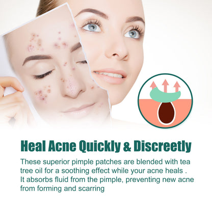 EELHOE Colorful Acne Patch, Repair And Clean The Mouth Blemish Clear Pocket Colorful Shaped Acne Patch