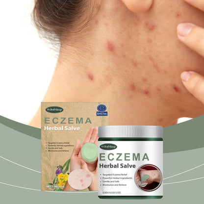 WoodSleep Herbal Cream Herbal Formula Relieves Skin Redness And Moisturizes Skin Externally