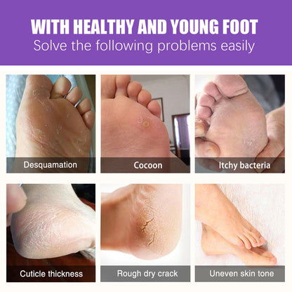 EELHOE Ginger Foot Mask (Box) Foot Moisturizing, Nourishing, Rejuvenating, Exfoliating, Removing Dead Skin, Dry And Cracked Skin Care Foot Mask
